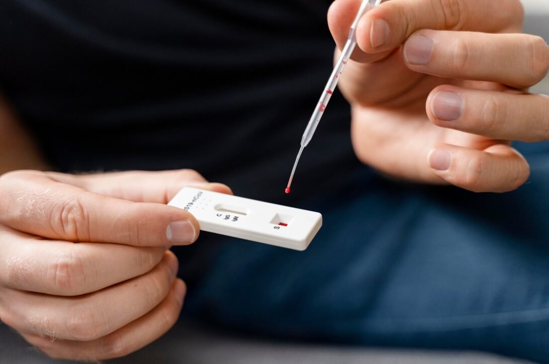 Same Day STD Testing: Fast, Confidential, and Reliable Options Explained